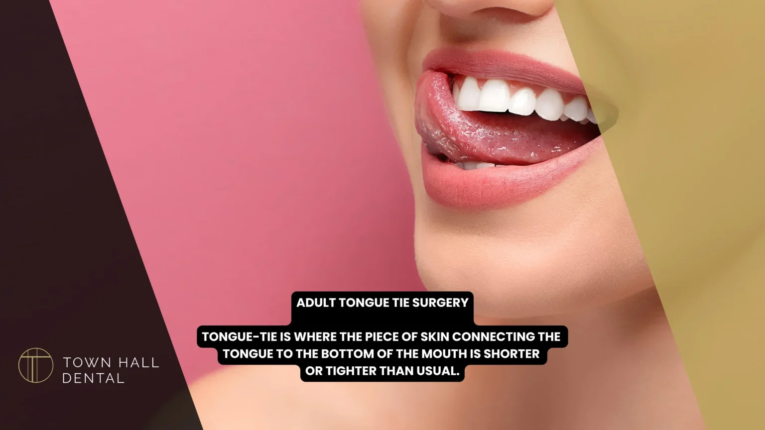 7 Signs You Might Need Adult Tongue Tie Surgery