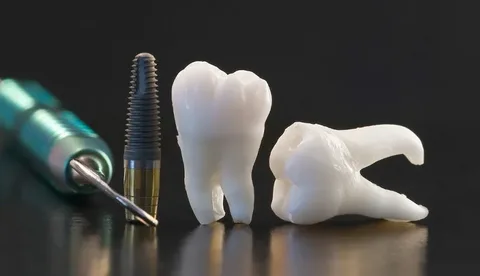 The Anatomy of a Gummy Smile: Exploring the Causes of Excessive Gingival Display