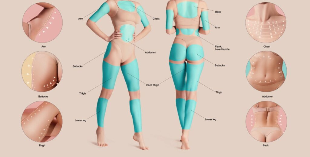 Why Your Body Shape Should Guide Your Lipo Plan